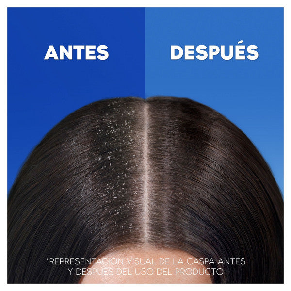 Erfrischendes Menthol-Shampoo - Head & Shoulders : 1000 ml - 6