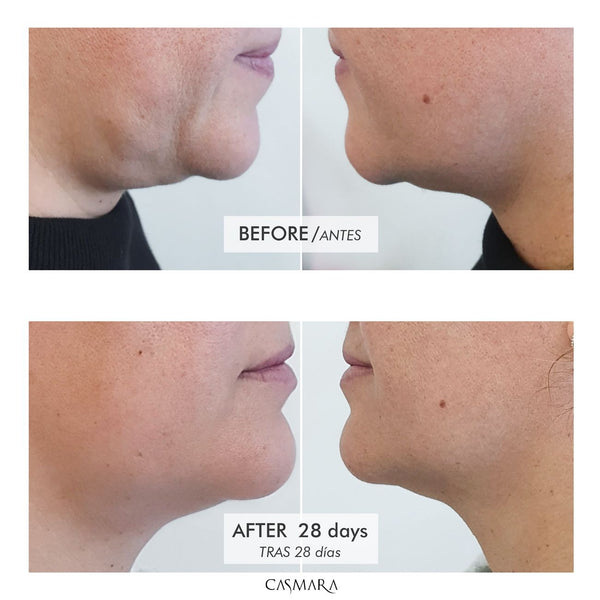 Strukturgebende Straffungscreme 100ml - Casmara - 3