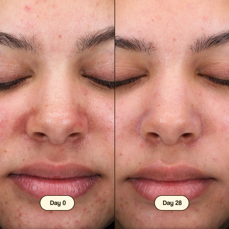 Gesichtsreiniger mit Salicylsäure 100ml - Freshly Cosmetics - 1