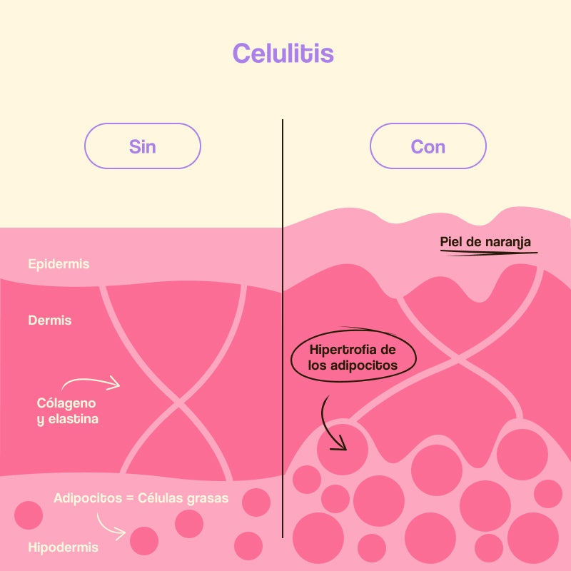 Anti-Cellulite- und Reduktionscreme Beta-Burner Sculpting 100ml - Freshly Cosmetics - 1
