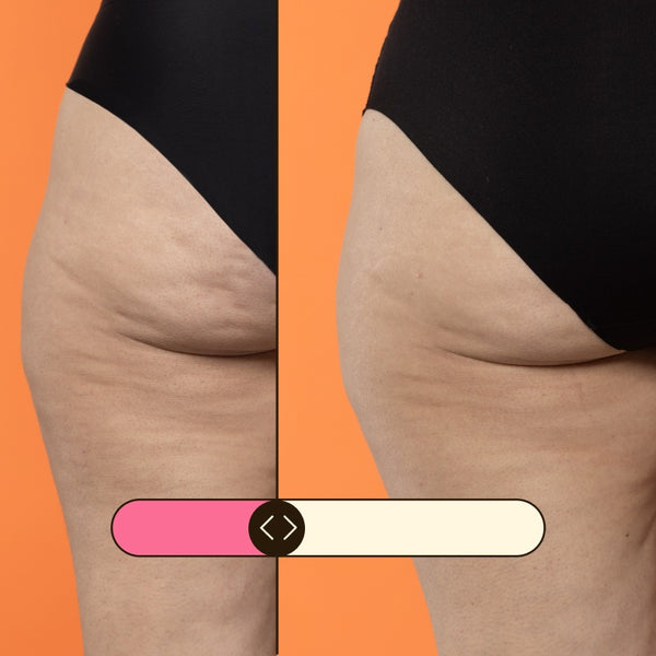 Anti-Cellulite- und Reduktionscreme Beta-Burner Sculpting 100ml - Freshly Cosmetics - 3