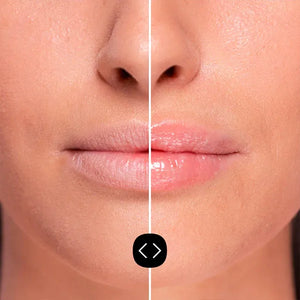 Hyaluronsäure Lippen Volumizer - Freshly Cosmetics - 2