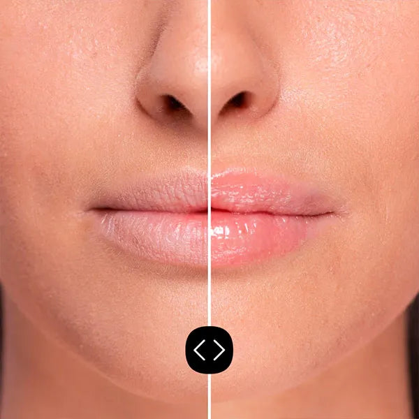 Hyaluronsäure Lippen Volumizer - Freshly Cosmetics - 2